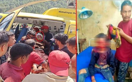 उत्तराखंड: भयावह भालू हमले में दो महिलाएं घायल, हेलीकॉप्टर से अस्पताल पहुंचाया गया