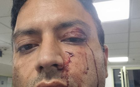 देहरादून: एनिमल लवर बताने वाले व्यापारी ने परिवार पर किया हमला, पिता-पुत्र गंभीर रूप से घायल