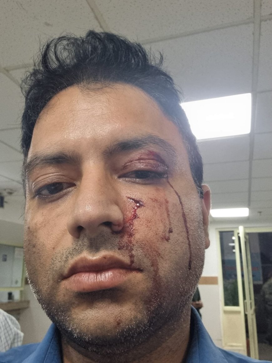 देहरादून: एनिमल लवर बताने वाले व्यापारी ने परिवार पर किया हमला, पिता-पुत्र गंभीर रूप से घायल