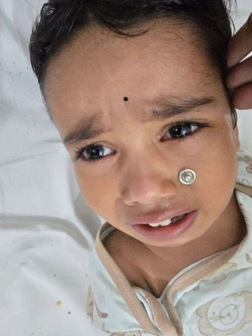 टनकपुर अस्पताल के डॉक्टर्स की कुशलता से बची मासूम की जिंदगी, बिना ऑपरेशन निकला नाक में फंसा धातु का बटन